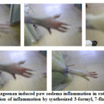 Figure 3: Carrageenan induced paw oedema inflammation in rats and gradual inhibition of inflammation by synthesized 3-formyl, 7-flavonols