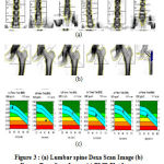 Figure 3(a): Lumbar spine Dexa Scan Image (b) Femur Dexa Scan Image (c) BMD Plot Image