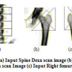 Figure 5: (a) Input Spine Dexa scan image (b) Input left femur Dexa scan Image (c) Input Right femur Dexa scan.
