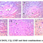 Figure 1: Histopathological effect of DOX, CQ, GMF and their combinations on the heart tissue, H&E stain, ×400.