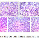 Figure 2: Histopathological effect of DOX, CQ, GMF and their combinations on the liver tissue, H&E stain, ×400.