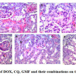 Figure 3: Histopathological effect of DOX, CQ, GMF and their combinations on the kidney tissue, H&E stain, ×400.