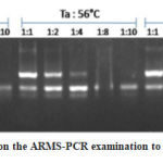 Figure 1: Three DNA bands on the ARMS-PCR examination to detect alleles from rs381386519