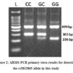 Figure 2: ARMS-PCR primary tetra results for detecting the rs3813865 allele in this study