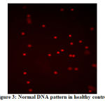 Figure 3: Normal DNA pattern in healthy control