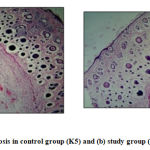 Figure 2: (A) Size of fibrosis in control group (K5) and (B) study group (P4). (H-E 40X)