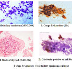 Figure 3: Category- 5 Medullary carcinoma Thyroid