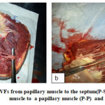 Figure 2: A, LVFs from papillary muscle to the septum(P-S) .B from papillary muscle to a papillary muscle (P-P) and P value ˂ 0.05