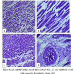 Figure 4: (a) and (b) Cardiac muscle fibers (10x & 40x) . (c) and (d) Blood vessels with connective &conductive tissue (40x).