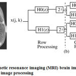 Figure 3: (a) Magnetic resonance imaging (MRI) brain image (b) Sub-band coding scheme for image processing