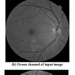 Figure 3: preprocessing of retinal image