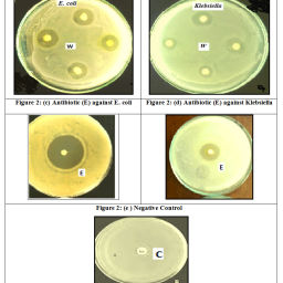 GC-MS Analysed Phyto-Chemicals and Antibacterial Activity of Withania ...