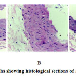 Figure 1: Photomicrographs showing histological sections of aorta abdominal of rats.