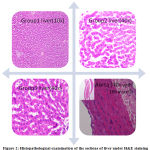 Figure 2: Histopathological examination of the sections of liver under H&E staining