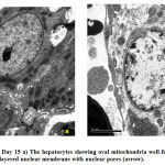 Figure 3: Control Day 15 a) The hepatocytes showing oval mitochondria well-formed rounded nucleus, b) double layered nuclear membrane with nuclear pores (arrow).