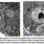 Figure 4: a) Exposed group Day 10: Marked proliferation of mitochondria and infiltration of fat vacuoles in the cytoplasm of the hepatocytes. b) Mitochondria changed shape and become rounded, no change seen in the nuclei which remained rounded with intact bilaminar membrane