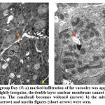 Figure 5: Exposed group Day 15: a) marked infiltration of fat vacuoles was apparent, shape of the nucleus becomes slightly irregular, the double layer nuclear membrane cannot be seen clearly and pores were not seen. The canaliculi becomes widened (arrow) b) the mitochondria becomes dumbbell shaped (arrow) and myelin figures (short arrow) were seen.