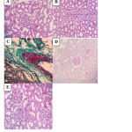 Figure 8: Histopathological sections of rat kidney in the different studied groups (A-E).
