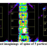 Figure 1: Sample DEXA test imaginings of spine of 5 particular specimen - DEXSIT-V2