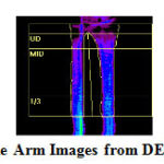 Figure 3: Sample Arm Images from DEXA database