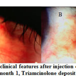 Figure 2: Changes in clinical features after injection of Triamcinolone
