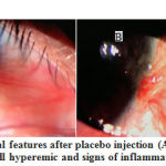 Figure 3: Changes in clinical features after placebo injection