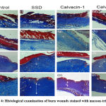 Figure 4: Histological examination of burn wounds stained with masson-trichrome