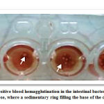 Picture 3B: Shows positive blood hemagglutination in the intestinal bacterium, without treating 2.5% of mannose, where a sedimentary ring filling the base of the drilling appears.