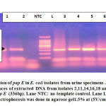 Figure 1: Detection of pap E in E. coli isolates from urine specimens.