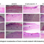 Figure 3: Histological examination of burn wounds stained with hematoxylin and eosin