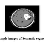 Figure 8: Sample images of Semantic segmentation