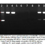 Figure 2: Triplex-PCR of S. aureus and determination of methicillin resistance samples.