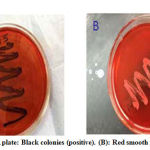 Figure 3: A) CRA plate: Black colonies (positive). (B): Red smooth colonies (negative)
