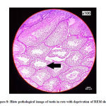 Figure 8: Histo pathological image of testis in rats with deprivation of REM sleep