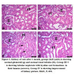 Figure 1: Kidney of rats after 1 month, groups I&II (a&b) is showing normal glomeruli (g) and normal renal tubules (tb).