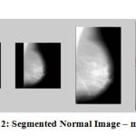 Figure 12: Segmented Normal Image – mdb014