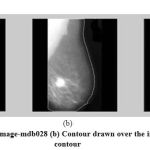 Figure 2: (a) Original image-mdb028 (b) Contour drawn over the image (c) Extracted contour