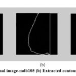 Figure 3: (a) Original image-mdb105 (b) Extracted contour (c) Mirror Image