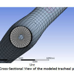 Figure 2: Cross-Sectional View of the modeled tracheal passage