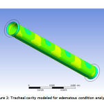 Figure 3: Tracheal cavity modeled for edematous condition analysis