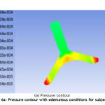 Figure 6a: Pressure contour with edematous conditions for subject 3