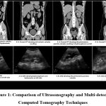 Figure 1: Comparison of Ultrasonography and multi-detector computed tomography techniques