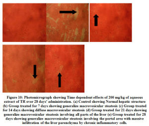 Figure 10: Photomicrograph showing Time dependent effects of 200 mg/kg of aqueous extract of TR over 28 days’ administration. (a) Control showing Normal hepatic structure (b) Group treated for 7 days showing generalize macrovesicular steatosis (c) Group treated for 14 days showing diffuse macrovesicular steatosis (d) Group treated for 21 days showing generalize macrovesicular steatosis involving all parts of the liver (e) Group treated for 28 days showing generalize macrovesicular steatosis involving the portal area with massive infiltration of the liver parenchyma by chronic inflammatory cells.
