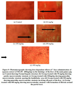 Figure 9: Photomicrographs showing dose-dependent effects of 7 days administration of aqueous extract of TR (50 - 400mg/kg) on the histology of the liver of the male guinea pig (a) Control showing Normal hepatic structure (b) Group treated with 50 mg/kg showing patchy macrovesicular steatosis (c) Group treated with 100mg/kg showing generalize macrovesicular steatosis sparing the lentilobular area (d) Group treated with 200 mg/kg showing generalize macrovesicular steatosis involving all parts of the liver (e) Group treated with 400 mg/kg showing macrovesicular steatosis with formation of fibrosis around the portal tract.