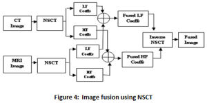 Figure 4: Image fusion using NSCT
