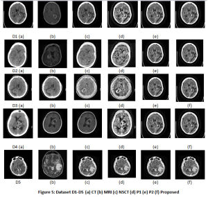 Figure 5: Dataset D1-D5 (a) CT (b) MRI (c) NSCT (d) P1 (e) P2 (f) Proposed