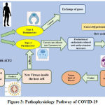 Figure 3: Pathophysiology Pathway of COVID-19