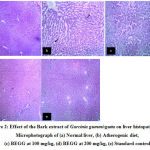Figure 2: Effect of the Bark extract of Garcinia gummi-gutta on liver histopathology. Microphotograph of (a) Normal liver, (b) Atherogenic diet, (c) BEGG at 100 mg/kg, (d) BEGG at 200 mg/kg, (e) Standard control