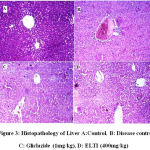 Figure 3: Histopathology of Liver A:Control, B: Disease control, C: Gliclazide (1mg/kg), D: ELTI (400mg/kg)