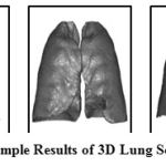 Figure 4: Sample Results of 3D Lung Segmentation